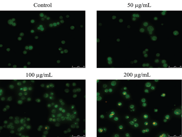 Nuclear morphological changes of HCT116 cells when treated  with different concentrations