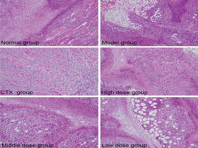  Results of histological observation in all groups (H22 solid tumor  mice, H and E, ×200)