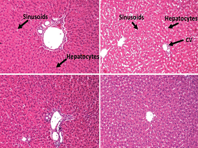   Effect of TFG on histopathological changes in liver