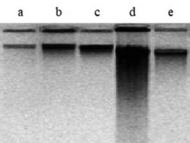 Gel picture of deoxyribonucleic acid fragmentation assay of  the pancreatic tissue