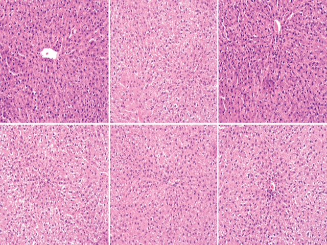 ffect of AP on the histological morphology of livers by hematoxylin-eosin staining