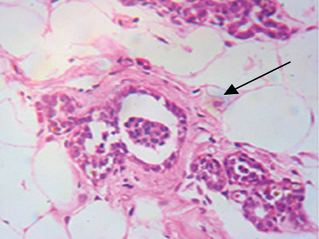Control groups showing normal ductal epithelium