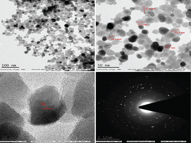 Transmission electron microscopy analysis of the synthesized 