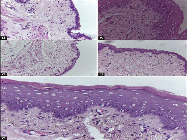 Photomicrographs of haematoxylin and eosin stained  transverse section of uterus of Vitex pinnata