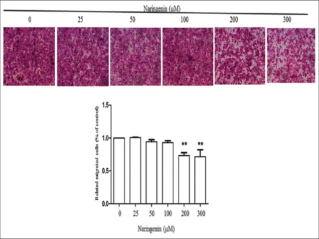 The cytotoxicity effect of naringenin in osteosarcoma cells. Human osteosarcoma 143B cells