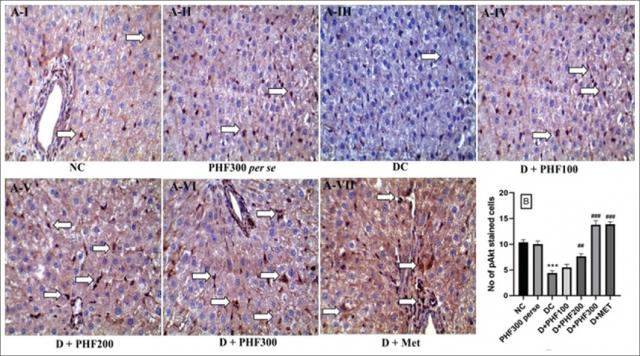 Polyherbal formulation improves glucose-lipid metabolism and prevent hepatotoxicity in streptozotocin-induced diabetic rats: Plausible role of IRS-PI3K-Akt-GLUT2 signaling