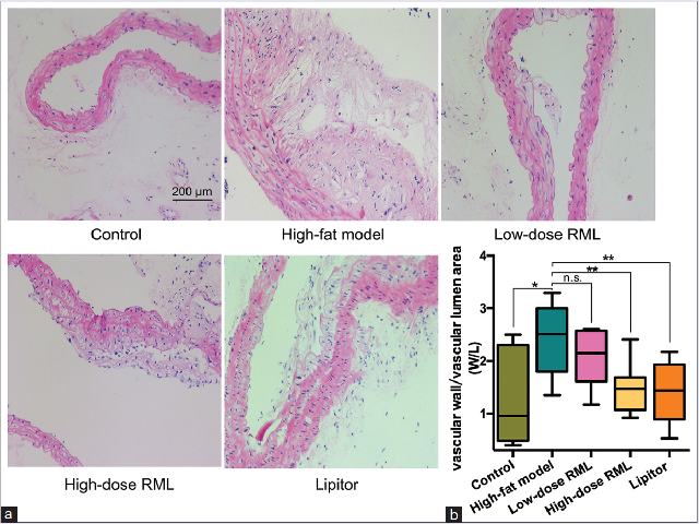  RML treatment reduced atherosclerosis in the thoracic aorta of ApoE−/− mice. (a) Pathological section of ApoE−/− mice thoracic aorta and H and E  staining  (200×)