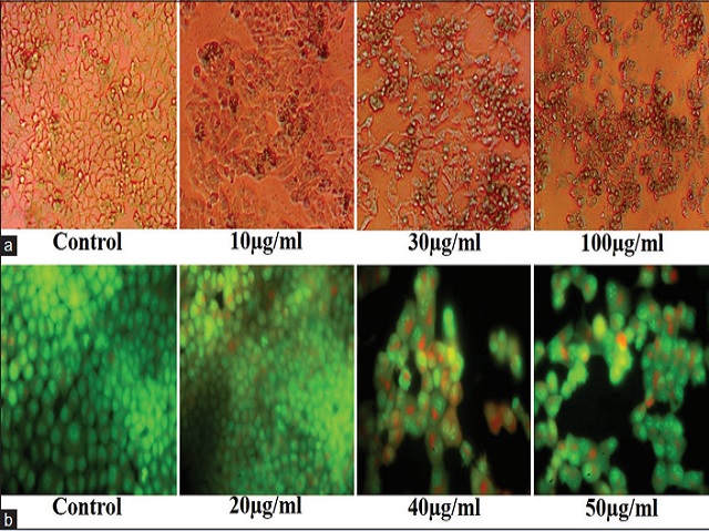 : Antiproliferative activity of brucine. (a) Morphometric analysis by phase‑contrast microscope shows morphological changes