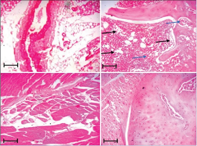 Histopathological examination of ipsilateral femurs of OVX rats  treated with ononin  (H&E staining)