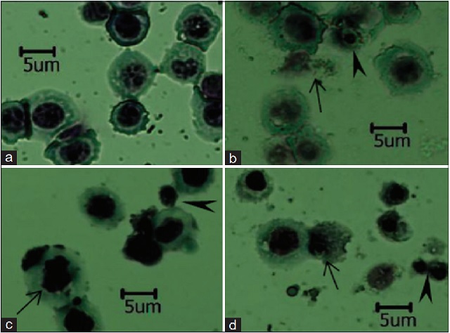 Morphological detection of MCF-7 cells with Giemsa staining