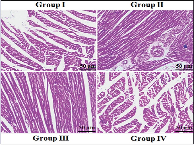  H  and  E staining of cardiac tissues in untreated and  gedunin-treated rats