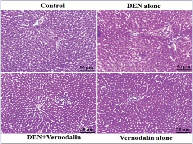 Effect of vernodalin on liver histopathology in control and  experimental rats