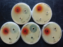 Anti-microbial activity of Rheum emodi by Agar well diffusion 
