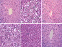 Histopathological appearance of rat liver cells