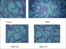  Effect of essential oil and ethanolic extract treatment on the  histomorphological changes of prostate sections