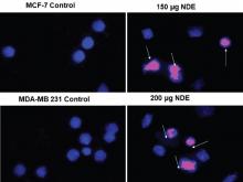 Ability of NDE to induce nuclear fragmentation in (a) MCF‑7 and (b) MDA‑MB 231 breast cancer cell lines. Hoechst 333258 and propedium iodide are shown in blue and pink pseudo colors, respectively. NDE: Nepeta deflersiana extract