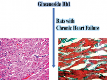 Effects of Ginsenoside Rb1 on Serum Brain Natriuretic Peptide Level and Caspase‑3 Protein Expression in Cardiomyocytes of Rats with Chronic Heart Failure
