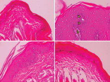 Histopathological changes in the oral mucosa of control and experimental hamsters.