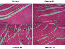 Cardioprotective Effect of Plumbagin and Amelioration of Pro‑Inflammatory Cytokines through Suppression of Na+/ K+‑ATPase on Myocardial Ischemia