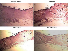 Histopathological sectioning of scar formation after wound healing
