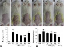 The ethanol extract of Caragana sinica ameliorated skin lesions in mice with contact dermatitis