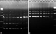 Genetic clonal fidelity assessment of rhizome-derived micropropagated Acorus calamus L. – A medicinally important plant by random amplified polymorphic DNA and inter-simple sequence repeat markers