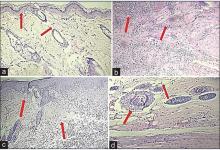 Histopathology images of the tissues obtained by incision  induced wounds from the Wistar rats 
