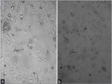 The morphology of untreated (a) and treated (b) HepG2 cells  with RJ at the concentration of IC50 for 48  hr