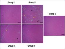  Effect of steroidal saponin dioscin on hippocampus  histomorphology in AlCl3 -exposed rats
