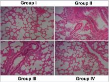 Ameliorative role of prunetin on lung histology in lung  cancer-induced mice